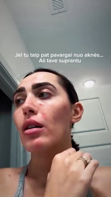skinandco.lithuania