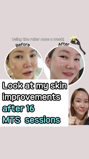 Instagram unniekshopsg