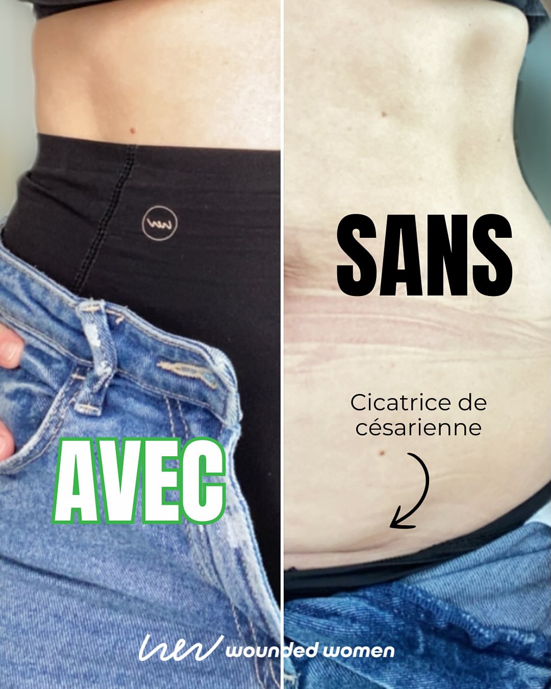 woundedwomen_officiel