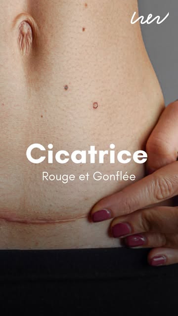 woundedwomen_officiel